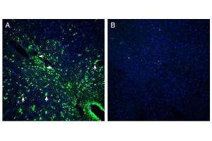 Expression of Presenilin-2 in mouse midbrain - Immunohistochemical staining of perfusion-fixed frozen mouse brain sections with Anti-Presenilin-2 Antibody (ABIN7043554, ABIN7044526 and ABIN7044527), (1:200), followed by goat anti-rabbit-AlexaFluor-488. (Presenilin 2 Antikörper  (Intracellular, N-Term))
