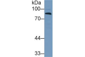 Western Blot; Sample: Human Lung lysate; Primary Ab: 1µg/ml Rabbit Anti-Human CFB Antibody Second Ab: 0. (Complement Factor B Antikörper  (AA 270-388))