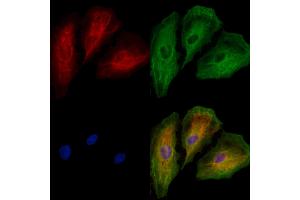 ABIN6259963 and ABIN6277562 staining  cells by IF/ICC.