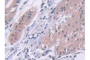 DAB staining on IHC-P; Samples: Human Stomach Tissue (ADAMTS10 Antikörper  (AA 239-602))