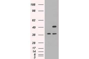 Image no. 1 for anti-CD4 (CD4) antibody (ABIN1497293)