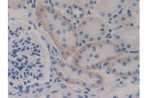 Immunohistochemistry (IHC) image for anti-Nuclear Factor of kappa Light Polypeptide Gene Enhancer in B-Cells Inhibitor, epsilon (NFKBIE) (AA 115-350) antibody (ABIN5013738)