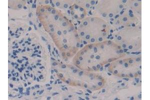 DAB staining on IHC-P; Samples: Mouse Kidney Tissue (NFKBIE Antikörper  (AA 115-350))