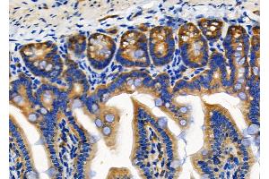 ABIN6257634 and ABIN6274771 at 1/100 staining Mouse colorectal tissue by IHC-P. (RPL18 Antikörper  (C-Term))