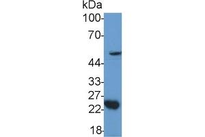 Detection of GDF11 in Mouse Cerebellum lysate using Polyclonal Antibody to Growth Differentiation Factor 11 (GDF11) (GDF11 Antikörper  (AA 299-407))