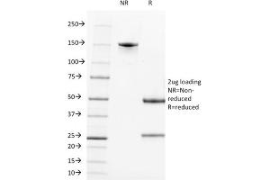SDS-PAGE Analysis Purified CD21 / CR2 Mouse Monoclonal Antibody (CR2/1952). (CD21 Antikörper  (AA 44-196))