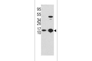 Western blot analysis of G8b (M1LC3B) Antibody (T6) 1802d in Y79 cell line lysates and mouse brain tissue lysates (35 μg/lane). (MAP1LC3A Antikörper  (AA 1-30))