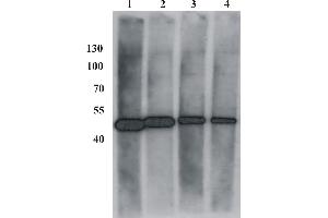 Western Blot testing of anti-BPV E2 monoclonal antibody (1E2). (Bovine Papilloma Virus 1 E2 (BPV-1 E2) (AA 182-190) Antikörper)
