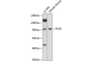 Western blot analysis of extracts of various cell lines, using FUT8 antibody (ABIN6132001, ABIN6140827, ABIN6140828 and ABIN6216749) at 1:3000 dilution. (FUT8 Antikörper  (AA 376-575))