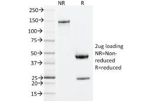 SDS-PAGE Analysis Purified ZAP70 Mouse Monoclonal Antibody (ZAP70/20535).