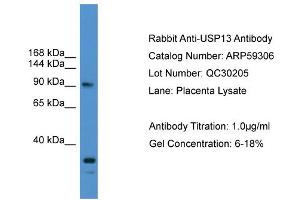 WB Suggested Anti-USP13  Antibody Titration: 0.