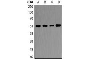 Western blot analysis of Ornithine Decarboxylase expression in Hela (A), THP1 (B), mouse kidney (C), mouse skeletal muscle (D) whole cell lysates. (ODC1 Antikörper)
