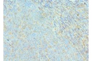 Immunohistochemistry of paraffin-embedded human tonsil tissue using ABIN7143076 at dilution of 1:100