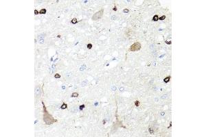 Immunohistochemistry (IHC) image for anti-Insulin-Like Growth Factor Binding Protein 5 (IGFBP5) (AA 68-167) antibody (ABIN6142257)