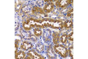 Immunohistochemistry of paraffin-embedded mouse kidney using PRKAB1 antibody (ABIN5995401) at dilution of 1/100 (40x lens). (PRKAB1 Antikörper)