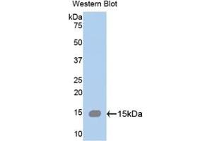 Detection of Recombinant SPTAN1, Human using Polyclonal Antibody to Alpha-Fodrin (SPTAN1) (SPTAN1 Antikörper  (AA 289-408))