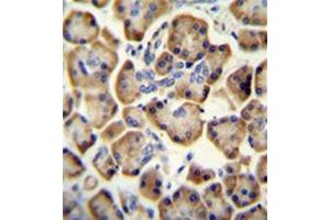 Formalin fixed and paraffin embedded Human pancreas tissue stained with RADIL Antibody (C-term) followed by peroxidase conjugation of the secondary antibody and DAB staining.