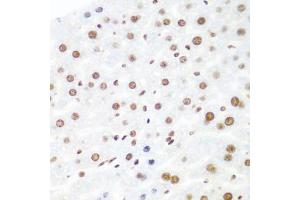 Immunohistochemistry of paraffin-embedded mouse liver using AGO2 antibody (ABIN5973585) at dilution of 1/100 (40x lens). (AGO2 Antikörper)