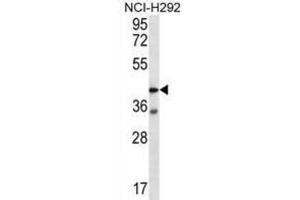 Western Blotting (WB) image for anti-Coagulation Factor II (thrombin) Receptor-Like 2 (F2RL2) antibody (ABIN2996634)