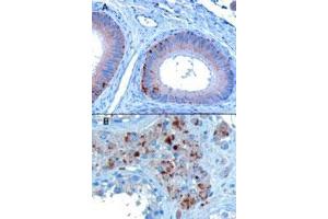 VPS35 polyclonal antibody  staining of paraffin embedded human testis showing A) Epithelial cells of the epididymis and B) Some leydig cells. (VPS35 Antikörper  (C-Term))