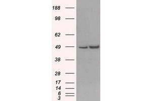 Western Blotting (WB) image for anti-LEM Domain Containing 3 (LEMD3) antibody (ABIN1499118) (LEMD3 Antikörper)