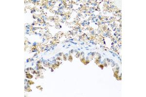 Immunohistochemistry of paraffin-embedded mouse lung using PI3 antibody at dilution of 1:100 (40x lens). (PI3 Antikörper)