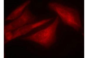 Immunofluorescence staining of methanol-fixed Hela cells using G3BP-1(Phospho-Ser232) Antibody. (G3BP1 Antikörper  (pSer232))