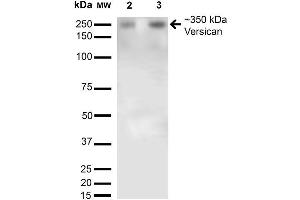 Western Blot analysis of Rat Brain Membrane and brain showing detection of 350kDa Versican protein using Mouse Anti-Versican Monoclonal Antibody, Clone S351-23 . (Versican Antikörper  (AA 362-585) (Atto 594))