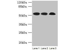 Western blot All lanes: SPERT antibody at 7 μg/mL Lane 1: Rat gonadal tissue Lane 2: Mouse lung tissue Lane 3: A549 whole cell lysate Secondary Goat polyclonal to rabbit IgG at 1/10000 dilution Predicted band size: 52, 48 kDa Observed band size: 52 kDa
