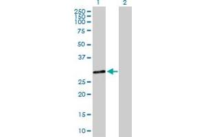 Western Blot analysis of DHRS9 expression in transfected 293T cell line by DHRS9 MaxPab polyclonal antibody. (DHRS9 Antikörper  (AA 1-319))
