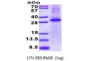 RCHY1 Protein (AA 1-261) (His tag)