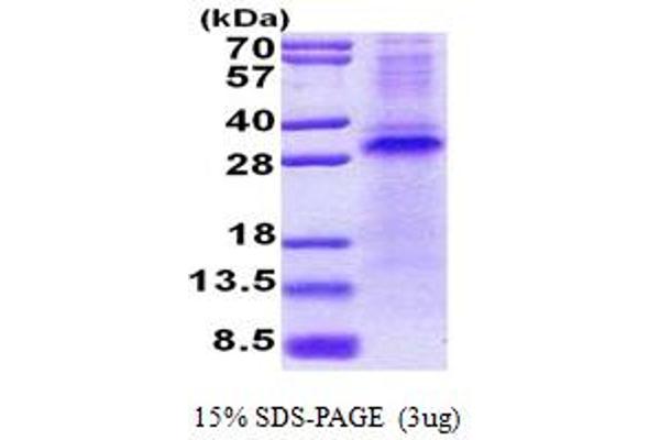 RCHY1 Protein (AA 1-261) (His tag)