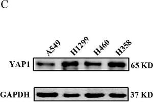 YAP1 expression levels in NSCLC tissues and NSCLC cell lines. (GAPDH Antikörper)