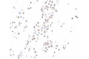 Immunocytochemistry (ICC) image for anti-Hepatitis A Virus Cellular Receptor 2 (TIM 3) (AA 22-201) antibody (ABIN7449550) (Rekombinanter TIM3 Antikörper  (AA 22-201))