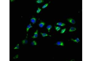 Immunofluorescence staining of A549 cells with ABIN7162659 at 1:200, counter-stained with DAPI. (PARD3 Antikörper  (AA 1068-1356))