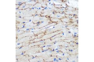 Immunohistochemistry of paraffin-embedded Mouse heart using Connexin 43 Rabbit pAb (ABIN6131701, ABIN6141098, ABIN6141099 and ABIN6215448) at dilution of 1:100 (40x lens). (Connexin 43/GJA1 Antikörper  (AA 233-382))