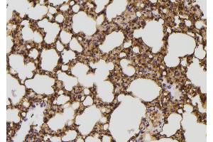 ABIN6274337 at 1/100 staining Mouse lung tissue by IHC-P. (IB2 Antikörper)