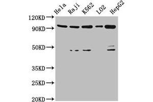 Western Blot Positive WB detected in: Hela whole cell lysate, Raji whole cell lysate, K562 whole cell lysate, LO2 whole cell lysate, HepG2 whole cell lysate All lanes: PROM1 antibody at 4. (CD133 Antikörper  (AA 508-792))