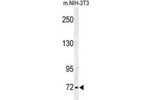 Western Blotting (WB) image for anti-Interleukin 1 Receptor Accessory Protein-Like 2 (IL1RAPL2) antibody (ABIN3003924)