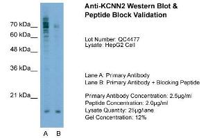 Host:  Rabbit  Target Name:  KCNN2  Sample Type:  HepG2  Lane A:  Primary Antibody  Lane B:  Primary Antibody + Blocking Peptide  Primary Antibody Concentration:  2.