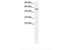 Image no. 1 for anti-Runt-Related Transcription Factor 1, Translocated To, 1 (Cyclin D-Related) (RUNX1T1) (AA 221-270) antibody (ABIN202771) (RUNX1T1 Antikörper  (AA 221-270))