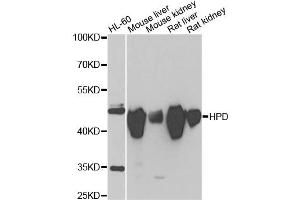 Western blot analysis of extracts of various cell lines, using HPD antibody (ABIN2563239) at 1:1000 dilution. (HPD Antikörper)