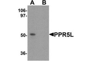 Western blot analysis of PRR5L in 3T3 cell lysate with PRR5L antibody at 1 μg/m in (A) the absence and (B) the presence of blocking peptide.