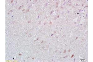 Formalin-fixed and paraffin embedded rat brain tissue labeled with Anti-Lingo-1 Polyclonal Antibody, Unconjugated  at 1:200 followed by conjugation to the secondary antibody and DAB staining (LINGO1 Antikörper  (AA 521-620))