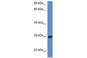 Western Blot showing STX2 antibody used at a concentration of 1 ug/ml against Fetal Heart Lysate (STX2 Antikörper  (N-Term))