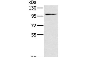 Western Blot analysis of Mouse heart tissue using KCNQ5 Polyclonal Antibody at dilution of 1:500