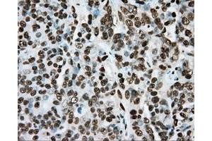 Immunohistochemical staining of paraffin-embedded colon tissue using anti-ARNT mouse monoclonal antibody. (ARNT Antikörper)