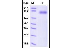 Human ROR1, His Tag on SDS-PAGE under reducing (R) condition. (ROR1 Protein (AA 30-403) (His tag))