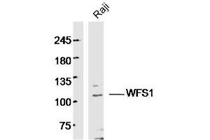 Human Raji cells probed with WFS1 Polyclonal Antibody, unconjugated  at 1:300 overnight at 4°C followed by a conjugated secondary antibody at 1:10000 for 90 minutes at 37°C. (WFS1 Antikörper  (AA 791-890))