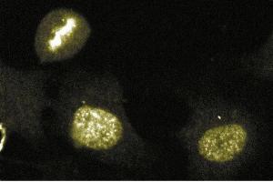 Immunofluorescence staining of human endothelial cells. (Aurora Kinase B Antikörper  (AA 2-124))